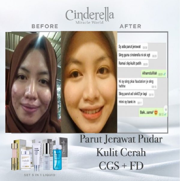cinderella_skin_care