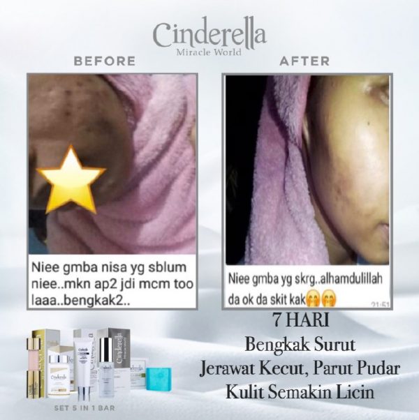 cinderella_skin_care3